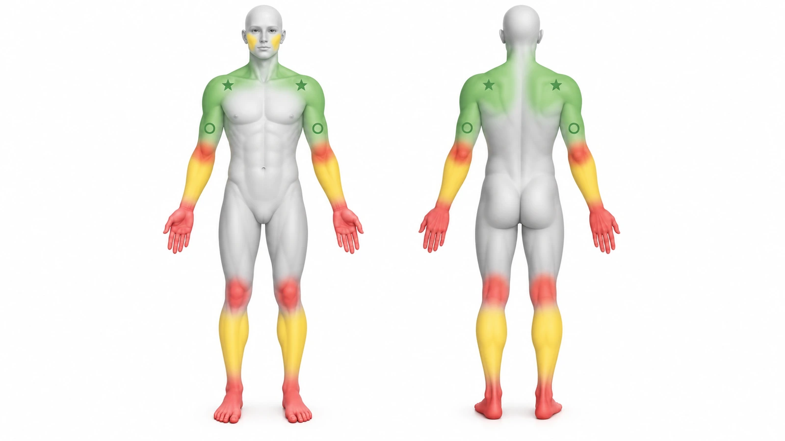 Siluetas del cuerpo de frente y de espalda codificadas por color: en verde, hombros, parte alta de la espalda y antebrazos interiores; en amarillo, antebrazos exteriores y pantorrillas; y en rojo, manos, dedos, muñecas, codos, rodillas y pies